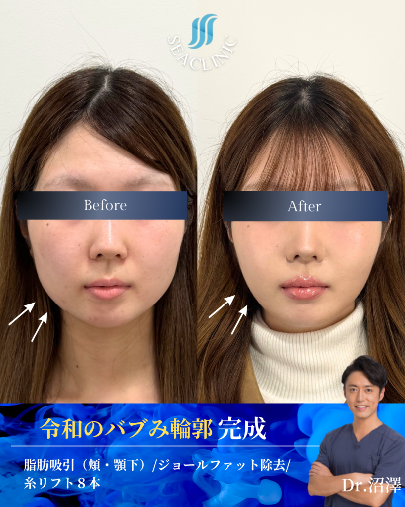 令和のバブみ輪郭完成！